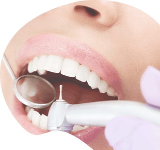 Лечение зубов - фото